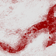 What Would It Take to End HIV Forever?